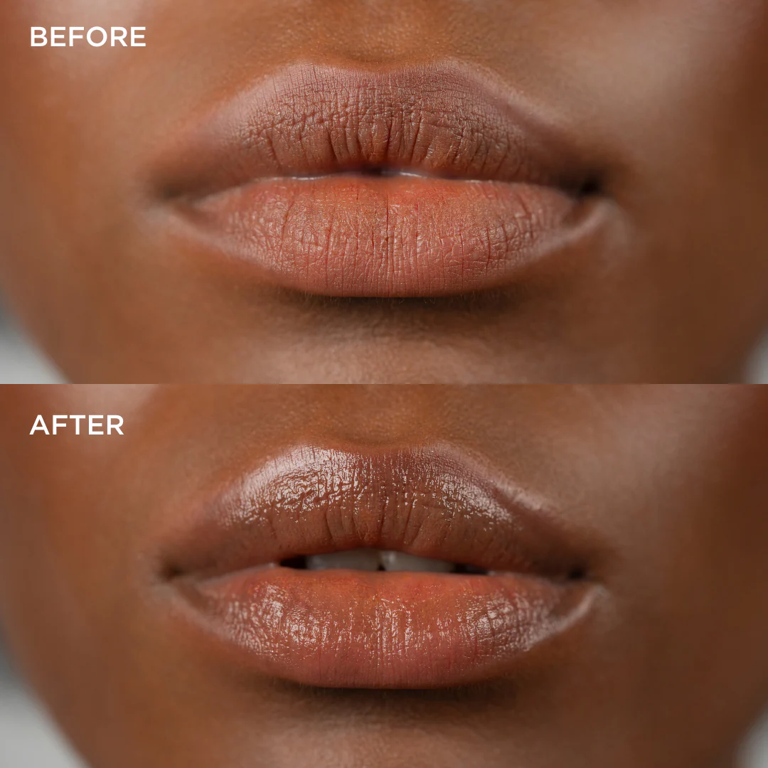 Watermelon Lip Balm - Image 6